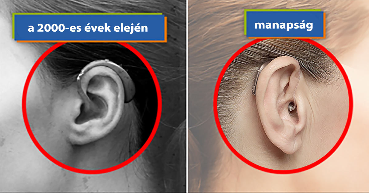 Kattints a képre, ha nagyobb méretben szeretnéd megtekinteni! Hozzánk közel álló halláscsökkenése